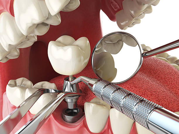 Best Root Canal Emergency Dentist  in Dana, NC